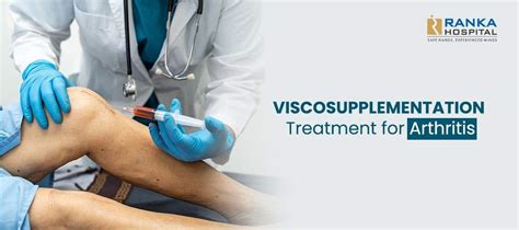 xuvan|Viscosupplementation for Arthritis: What to Expect .